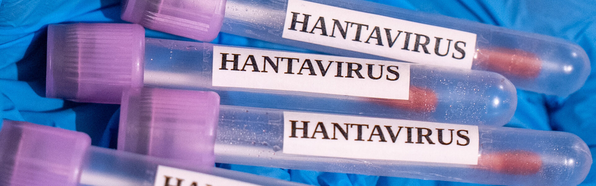 Evacuations For Cruise Ship Begin After Hantavirus Outbreak Leaves Multiple Dead (VIDEO)