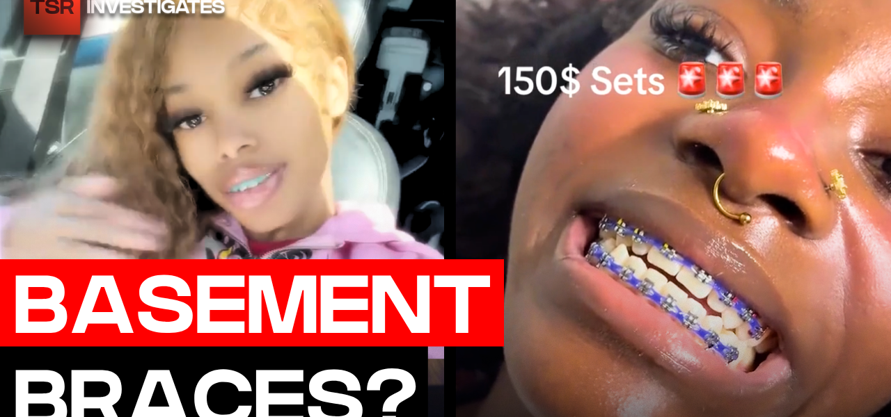 Basement Braces Are Going Viral And Dentists Are Concerned