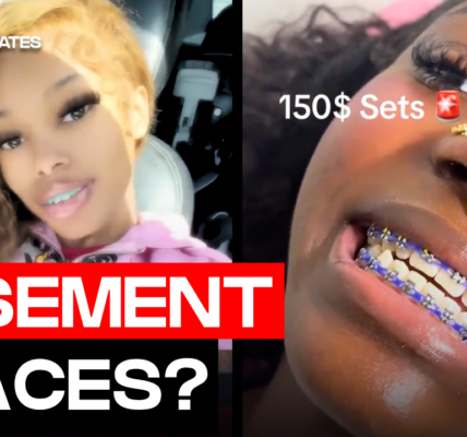 Basement Braces Are Going Viral And Dentists Are Concerned