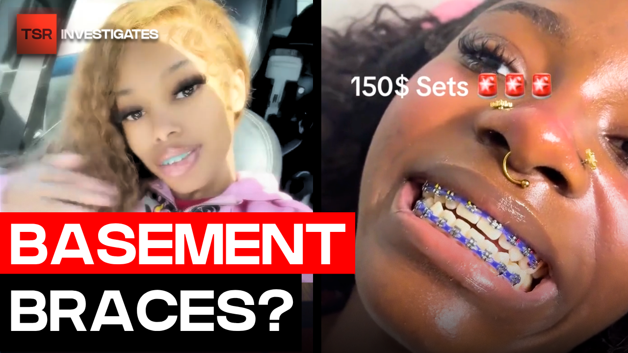 Basement Braces Are Going Viral And Dentists Are Concerned